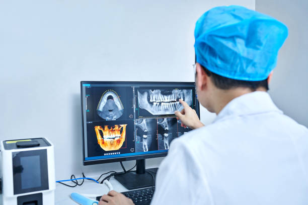Best Knocked-Out Tooth (Avulsed Tooth) Treatment in Claxton, GA